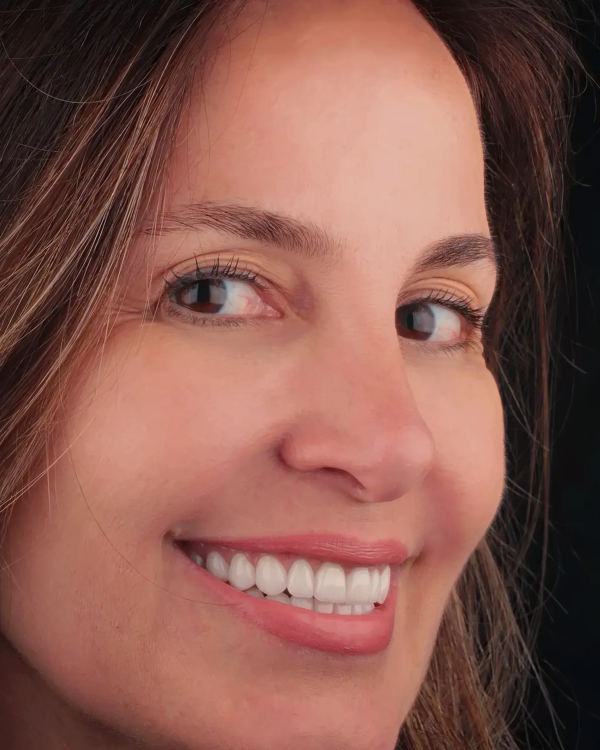 Close de rosto sorrindo, com lentes de contato dental em porcelana