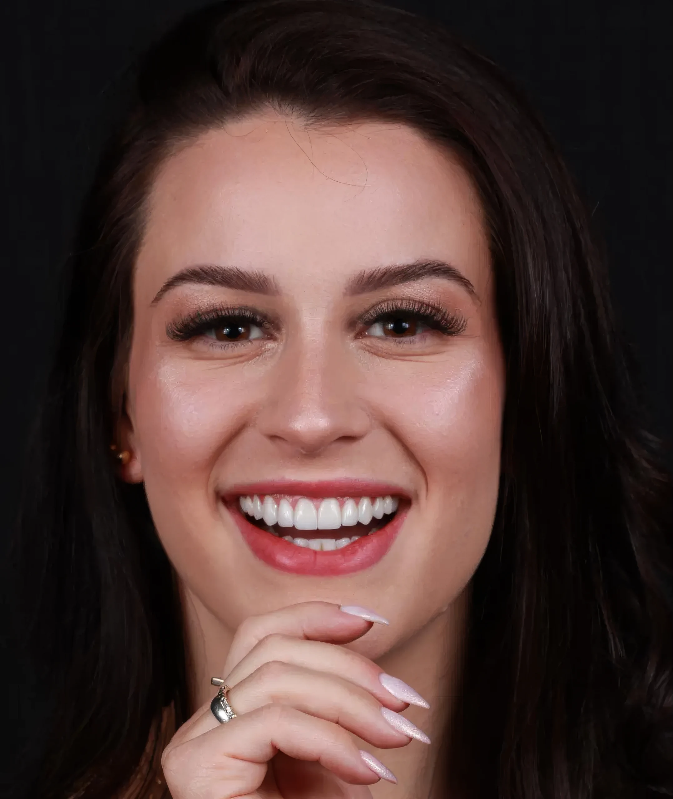 Mulher de cabelos escuros sorrindo, com lentes de contato dental em porcelana