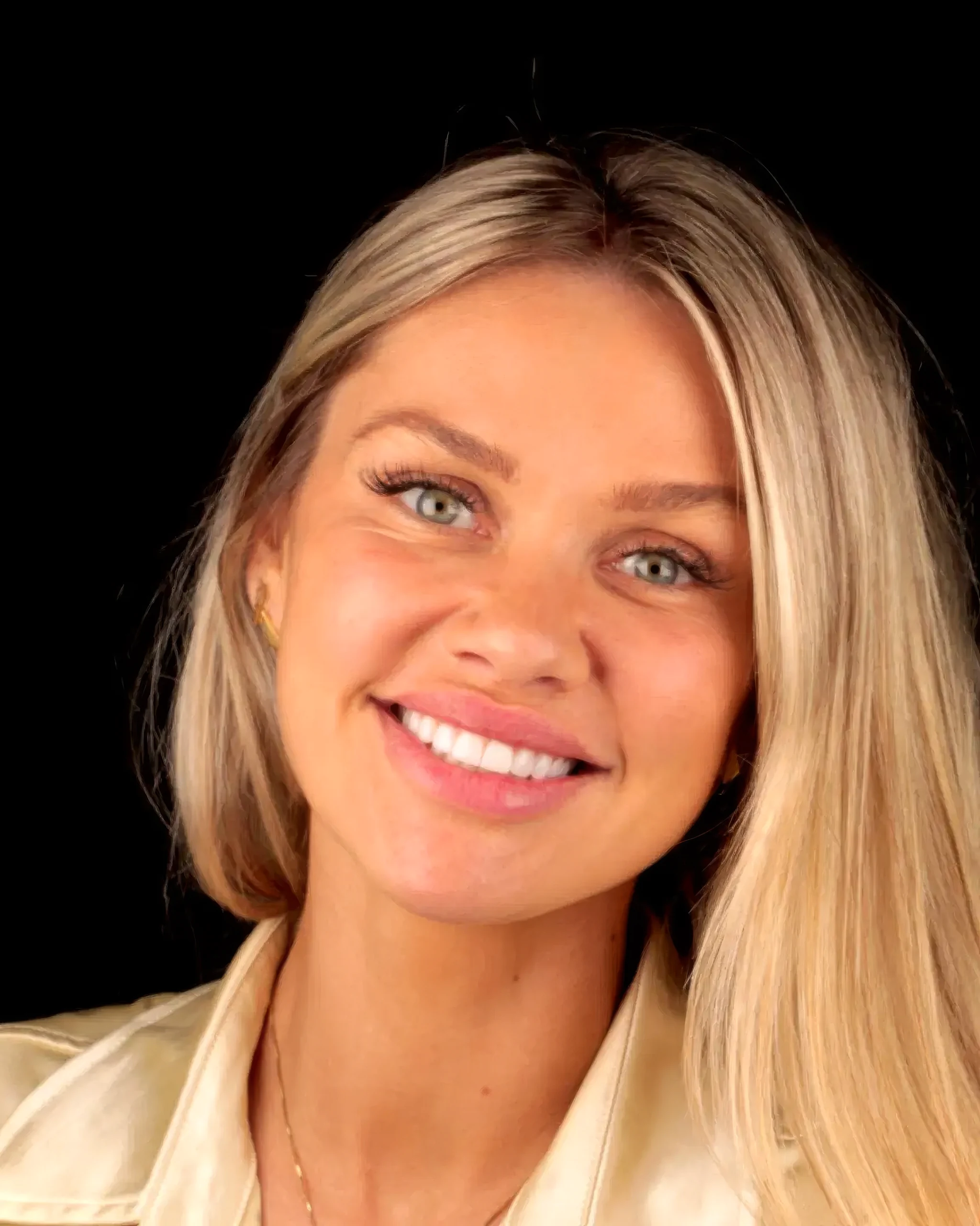 Mulher loira sorrindo, com lentes de contato dental em porcelana